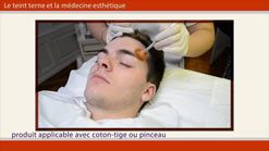 CONTRE LE TEINT TERNE : PEELING AU MASCULIN (TEXTE ET VIDÉO)