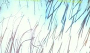anisotrichose