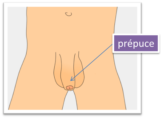 La circoncision ou Posthectomie